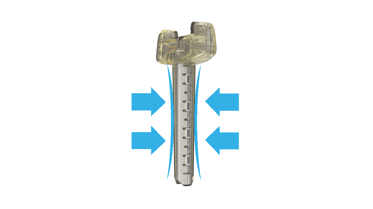 Tibial Nail TNAdvanced™ System DePuy Synthes